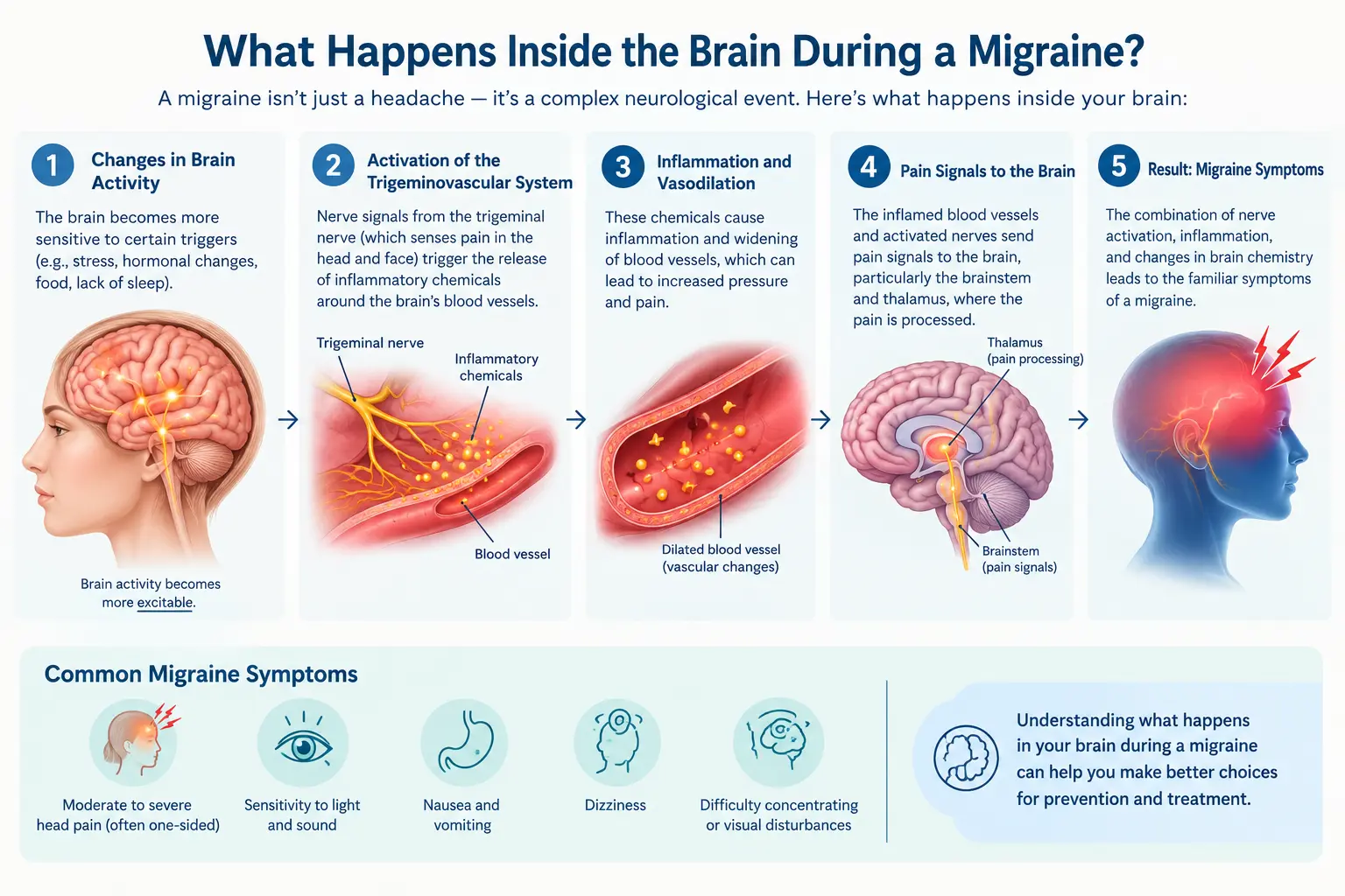 What Happens Inside the Brain During a Migraine